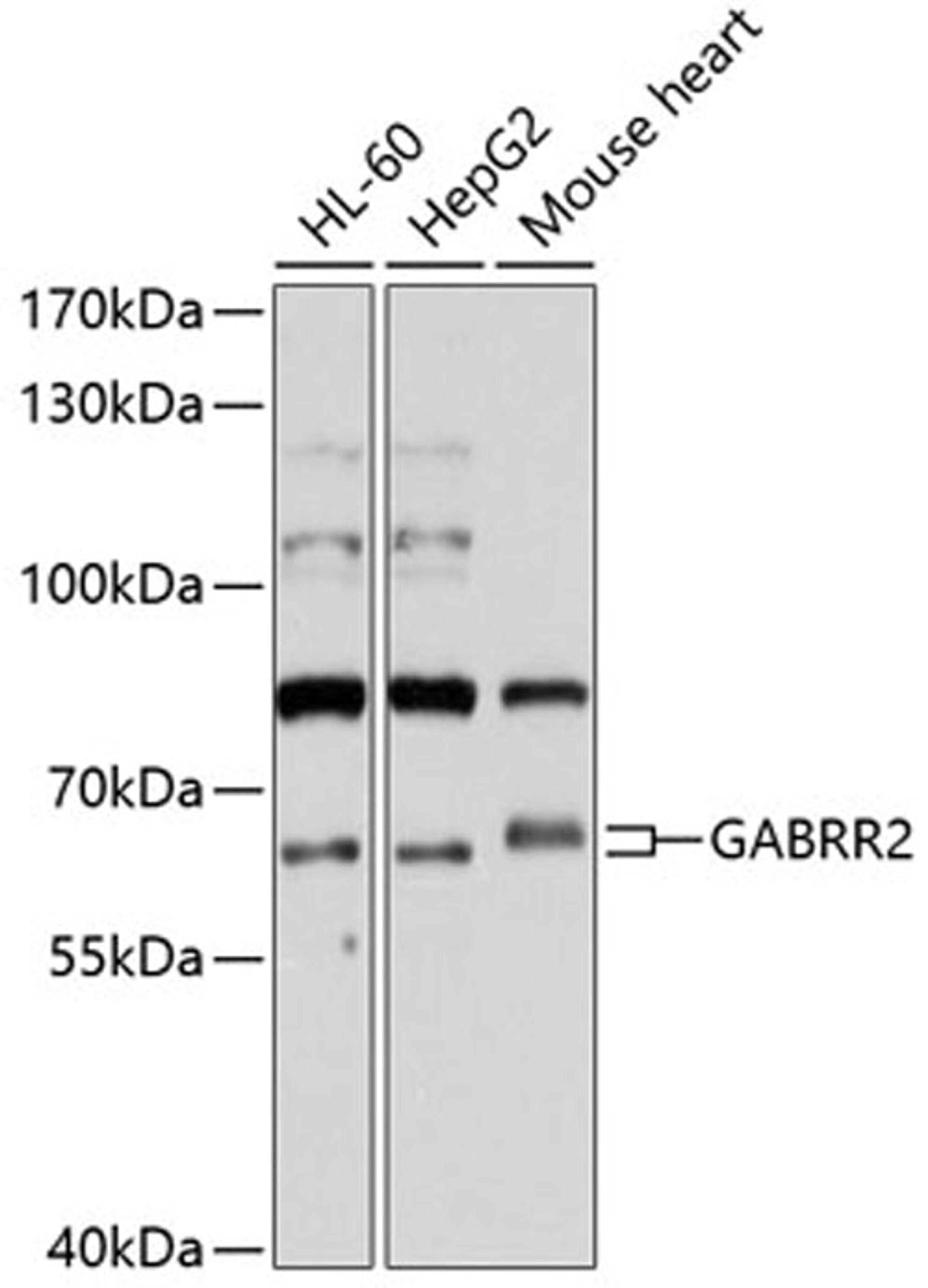 Western blot - GABRR2 antibody (A10111)