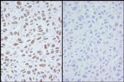 Detection of mouse Phospho SMC1 (Ser 966) by immunohistochemistry.