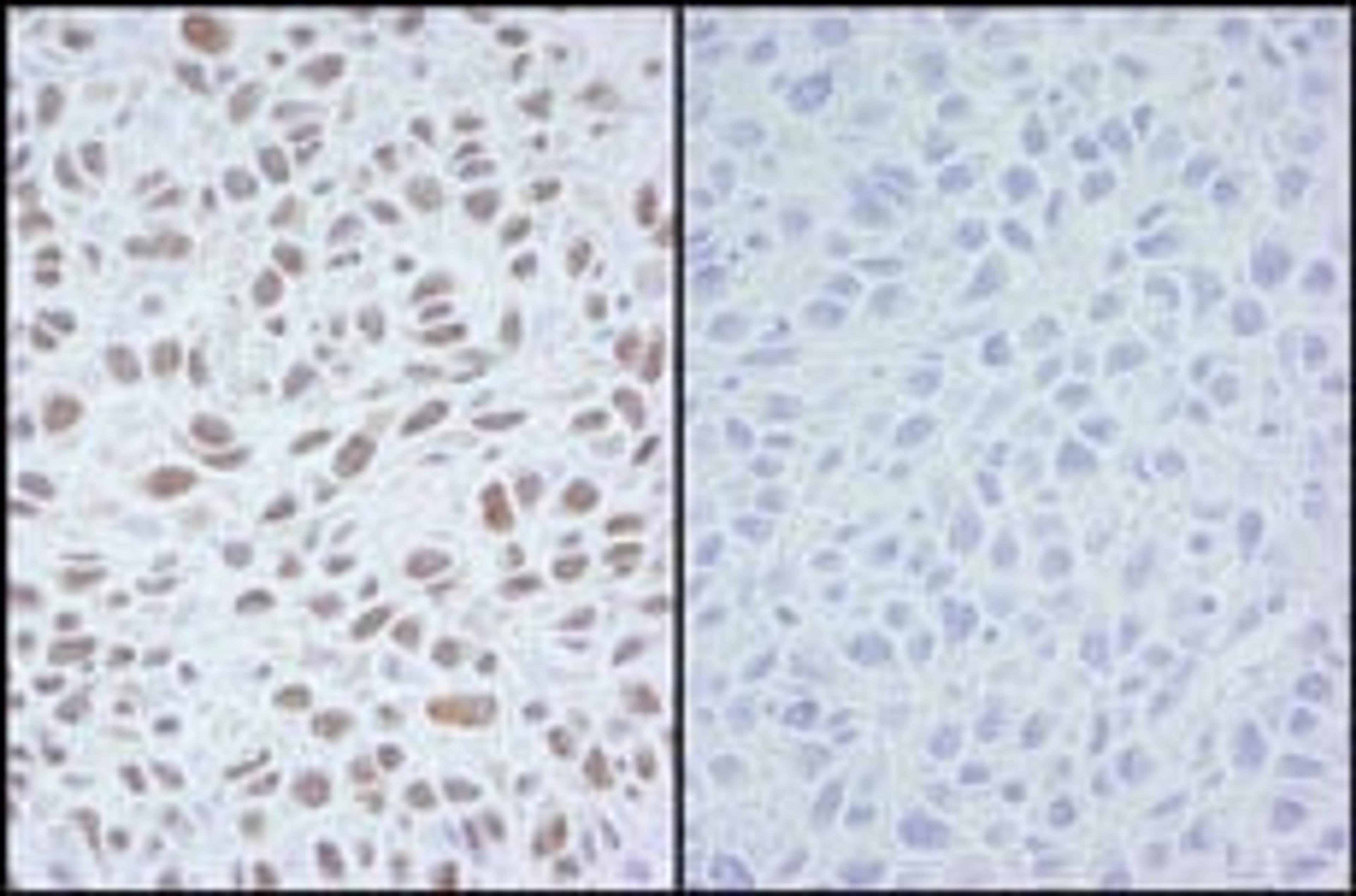 Detection of mouse Phospho SMC1 (Ser 966) by immunohistochemistry.