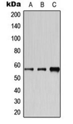 Western blot analysis of HeLa (Lane 1), Jurkat (Lane 2), MCF7 (Lane 3) whole cell lysates using CYP2A6 antibody