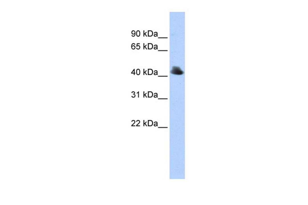 Antibody used in WB on Human 293T at 0.2-1 ug/ml.