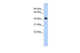 Antibody used in WB on Human 293T at 0.2-1 ug/ml.