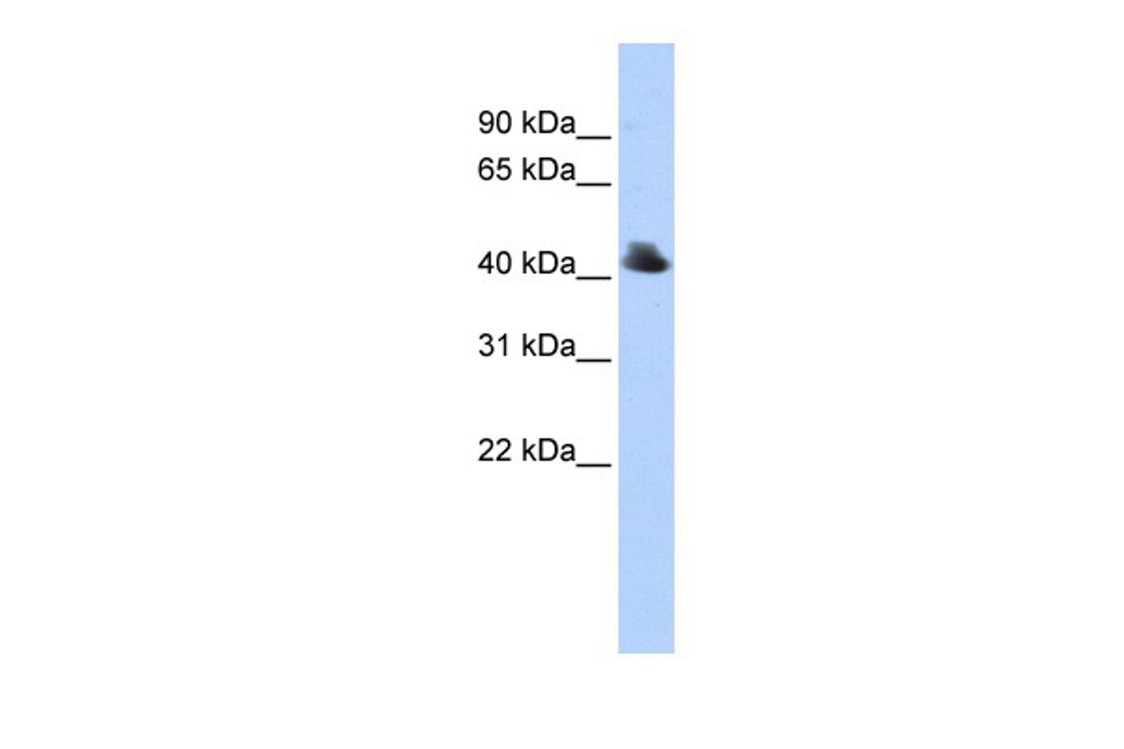 Antibody used in WB on Human 293T at 0.2-1 ug/ml.