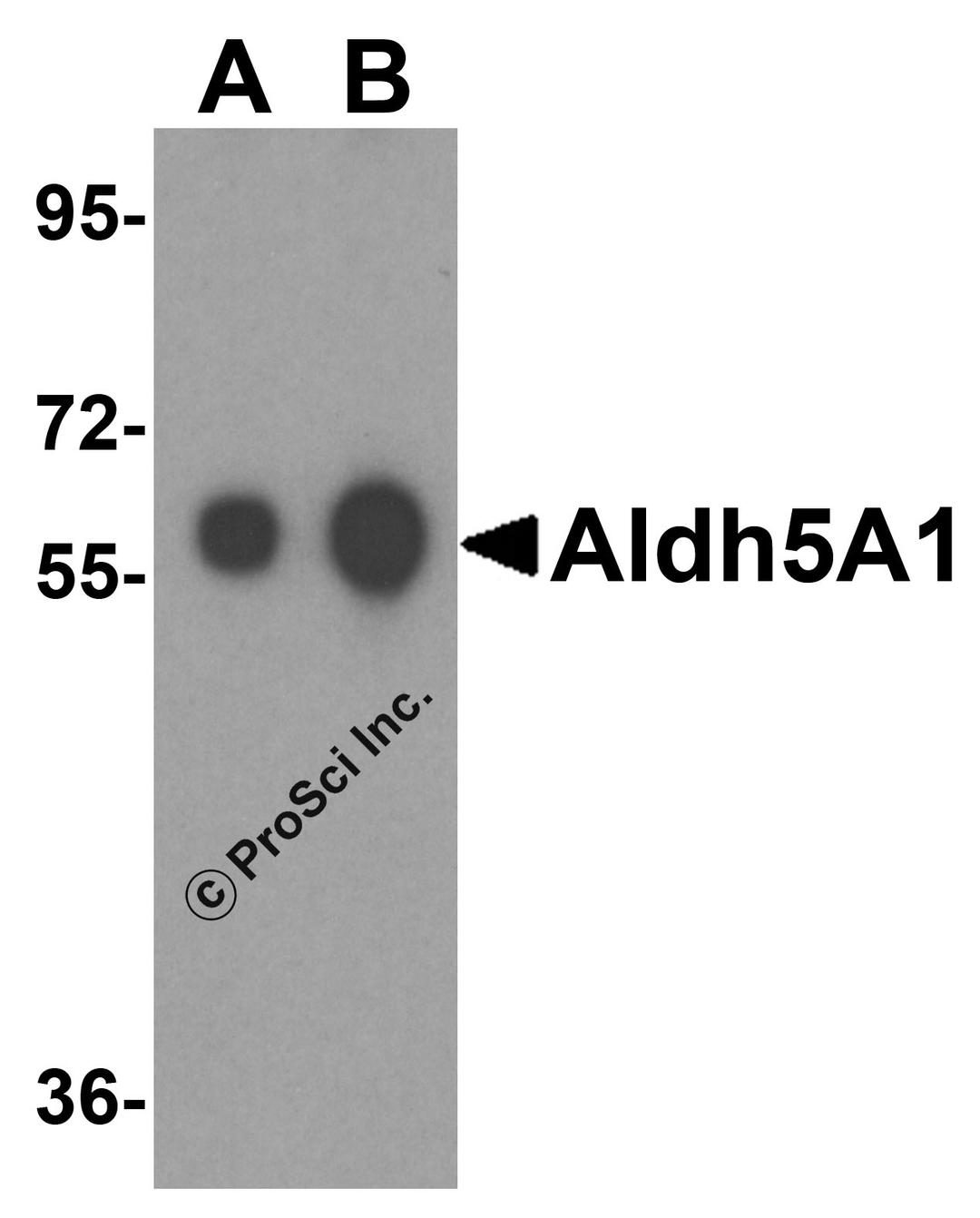 Western blot analysis of Aldh5A1 in human liver tissue lysate with Aldh5A1 antibody at (A) 0.25 and (B) 0.5 μg/mL.