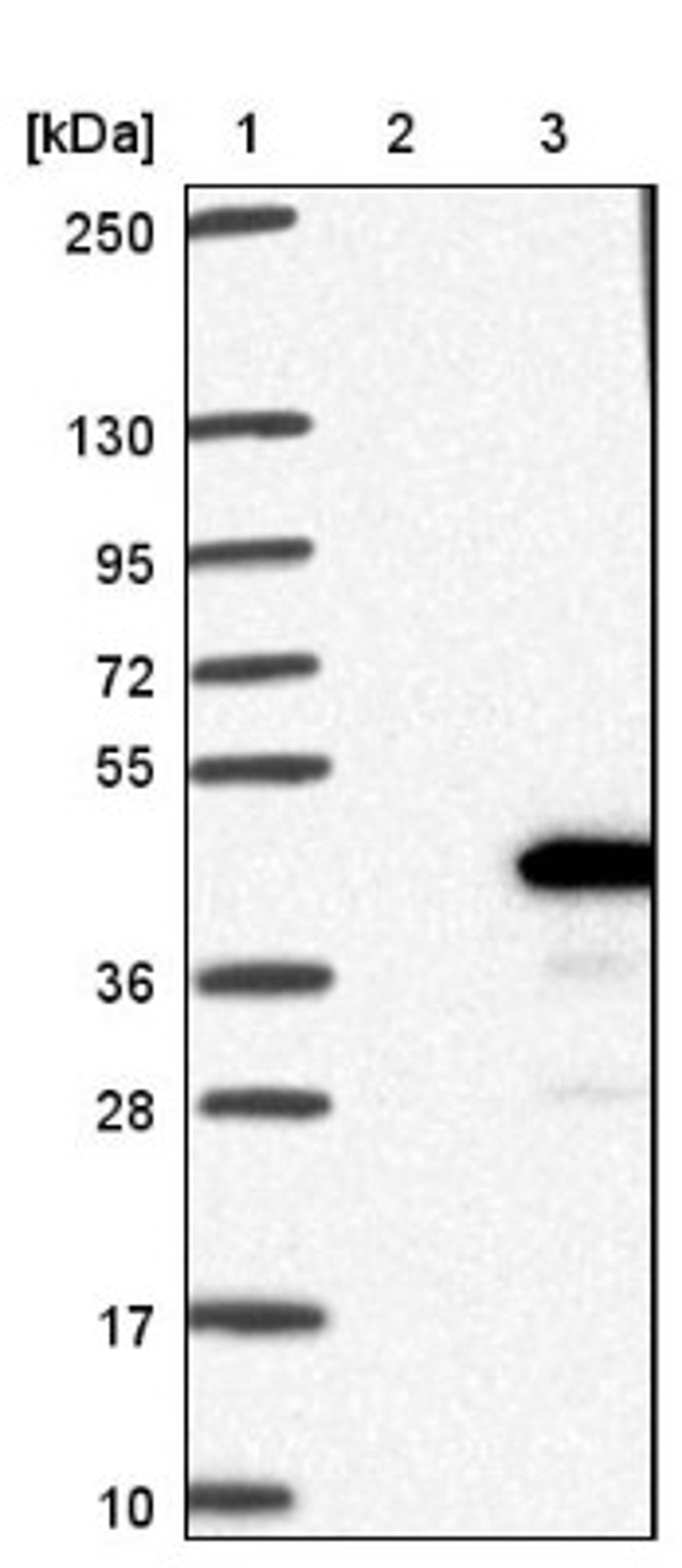 Western Blot: THAP10 Antibody [NBP1-86226] - Lane 1: Marker [kDa] 250, 130, 95, 72, 55, 36, 28, 17, 10<br/>Lane 2: Negative control (vector only transfected HEK293T lysate)<br/>Lane 3: Over-expression lysate (Co-expressed with a C-terminal myc-DDK tag (~3.1 kDa) in mammalian HEK293T cells, LY412551)