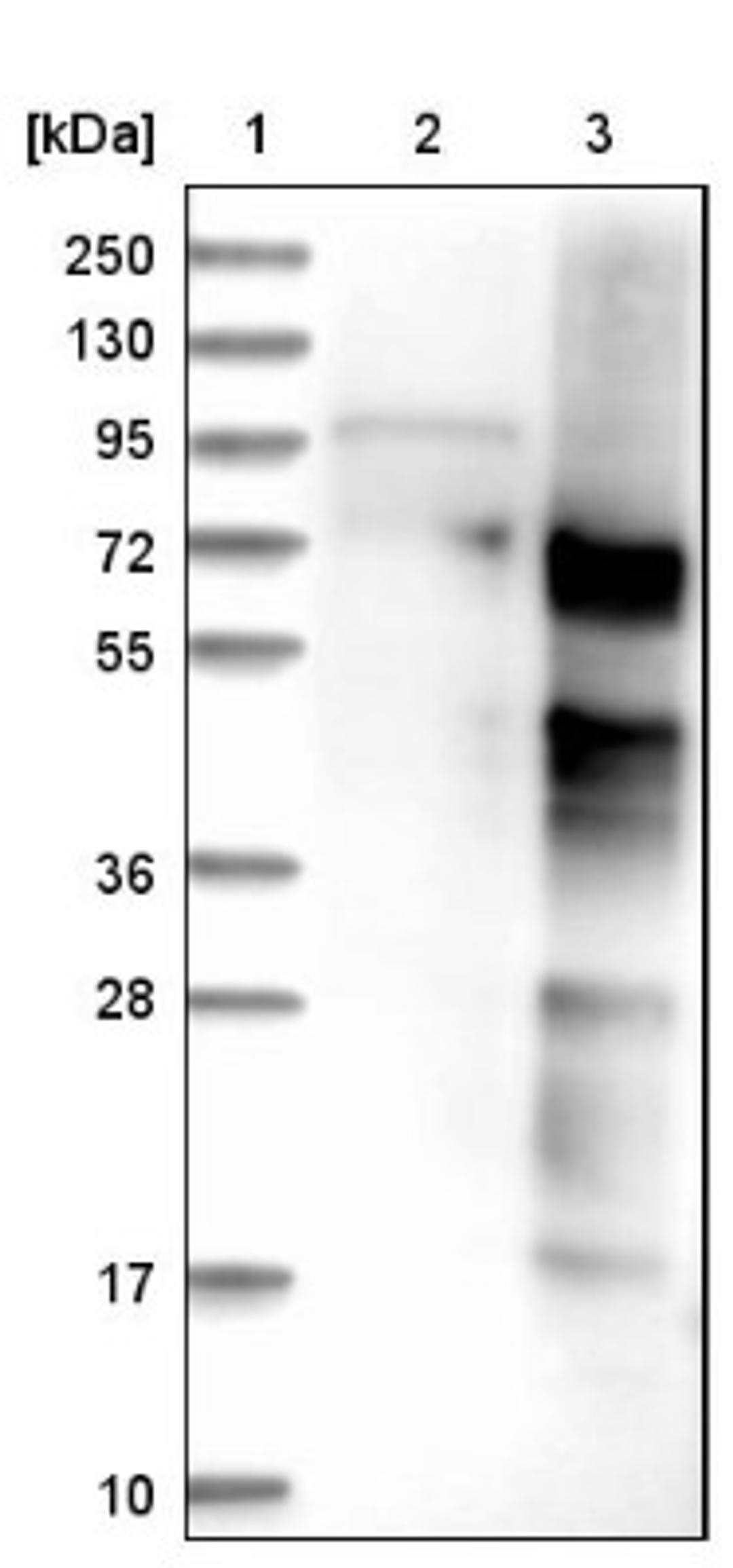 Immunohistochemistry: IQCJ-SCHIP1 Antibody [NBP1-90887] - Lane 1: Marker [kDa] 250, 130, 95, 72, 55, 36, 28, 17, 10<br/>Lane 2: Negative control (vector only transfected HEK293T lysate)<br/>Lane 3: Over-expression lysate (Co-expressed with a C-terminal myc-DDK tag (~3.1 kDa) in mammalian HEK293T cells, LY415194)