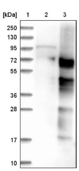 Immunohistochemistry: IQCJ-SCHIP1 Antibody [NBP1-90887] - Lane 1: Marker [kDa] 250, 130, 95, 72, 55, 36, 28, 17, 10<br/>Lane 2: Negative control (vector only transfected HEK293T lysate)<br/>Lane 3: Over-expression lysate (Co-expressed with a C-terminal myc-DDK tag (~3.1 kDa) in mammalian HEK293T cells, LY415194)