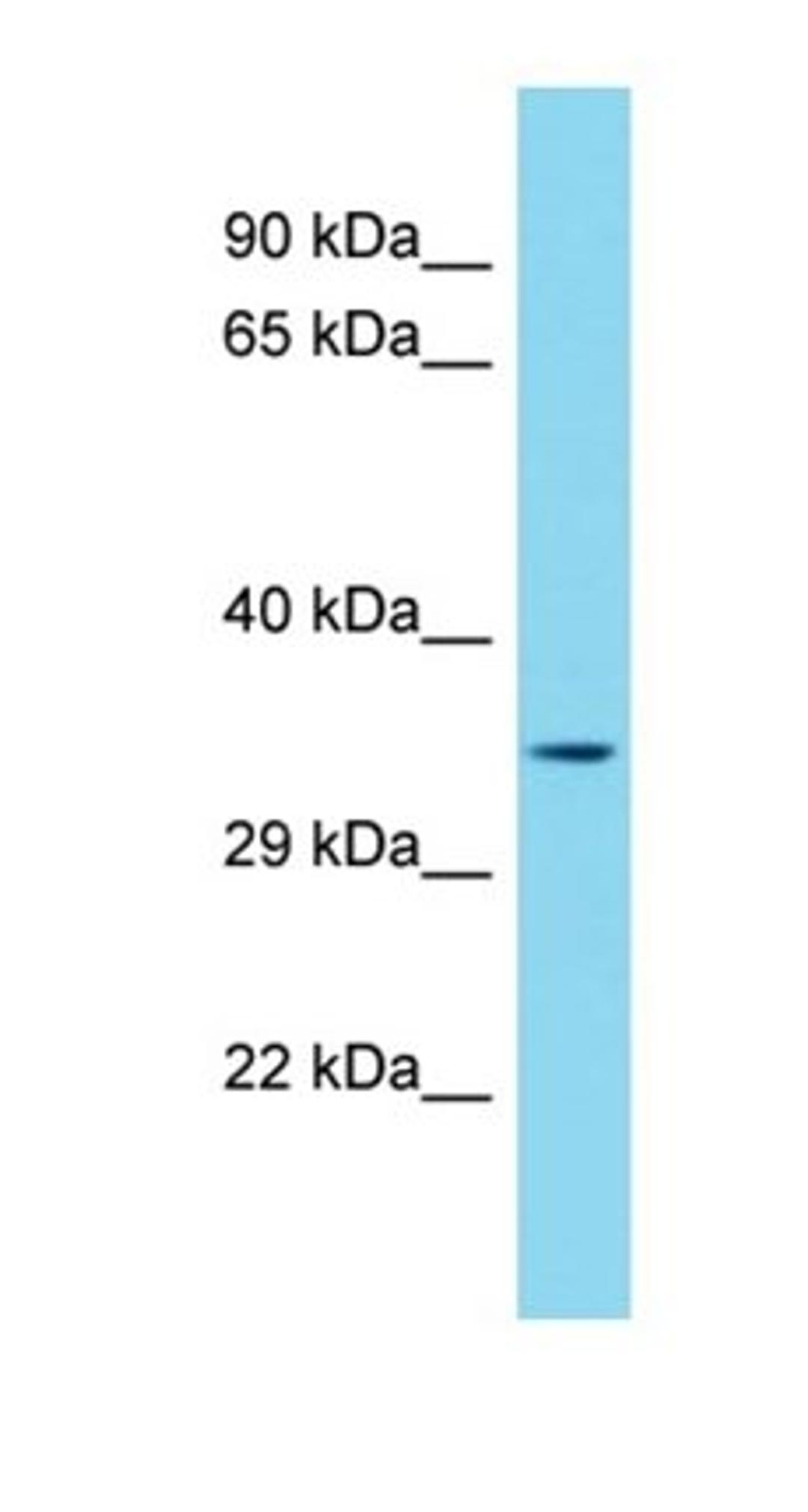 Western blot analysis of human HepG2 tissue using MEDAG antibody