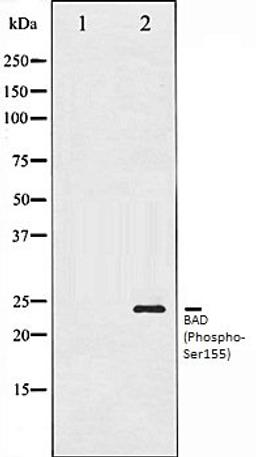 Western blot analysis of 293 whole cell lysates using BAD (Phospho-Ser155) antibody, The lane on the left is treated with the antigen-specific peptide.