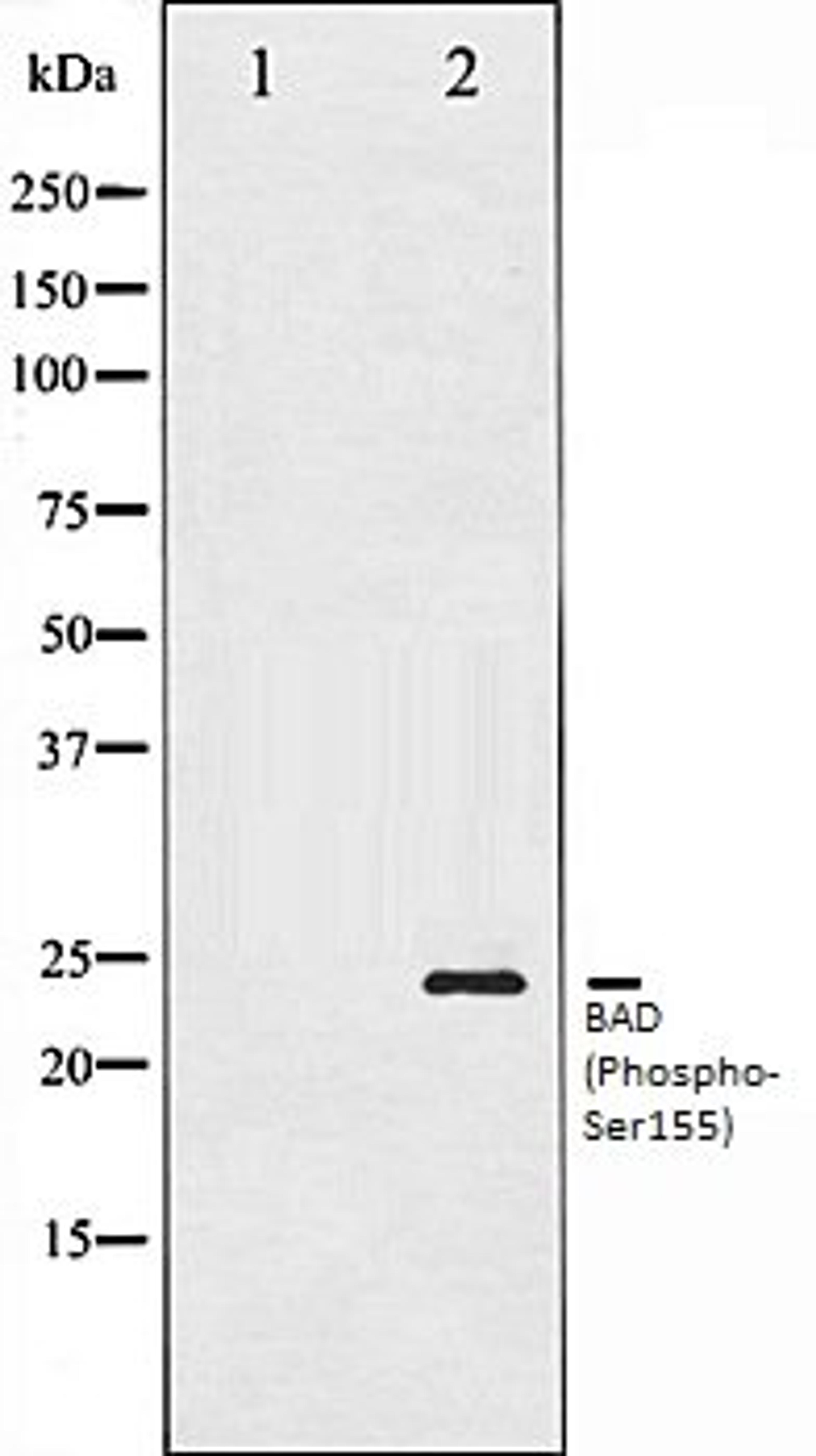 Western blot analysis of 293 whole cell lysates using BAD (Phospho-Ser155) antibody, The lane on the left is treated with the antigen-specific peptide.