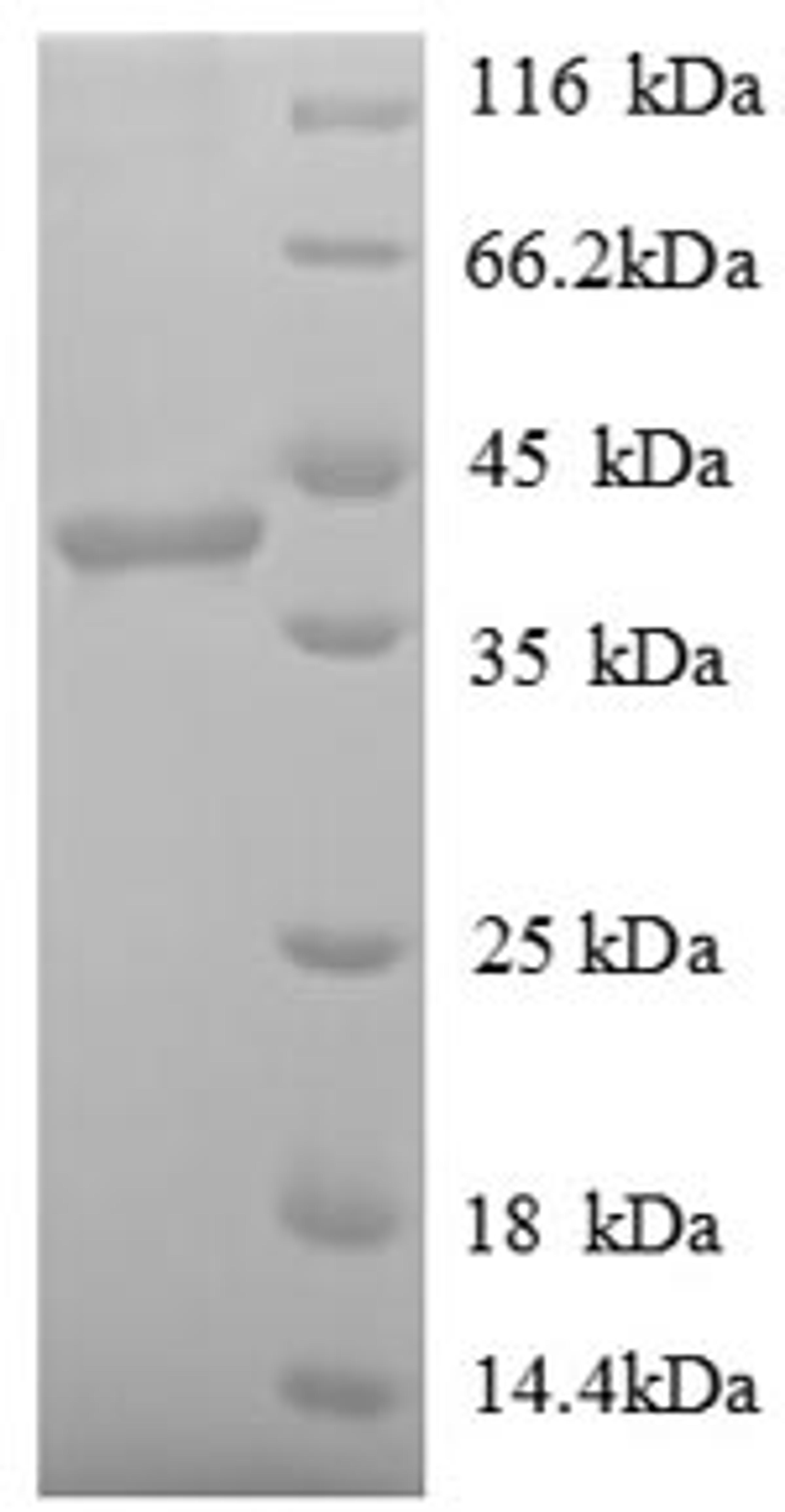 (Tris-Glycine gel) Discontinuous SDS-PAGE (reduced) with 5% enrichment gel and 15% separation gel.