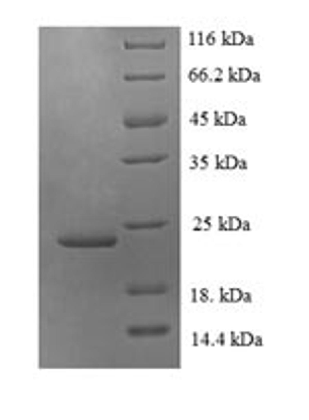 (Tris-Glycine gel) Discontinuous SDS-PAGE (reduced) with 5% enrichment gel and 15% separation gel.