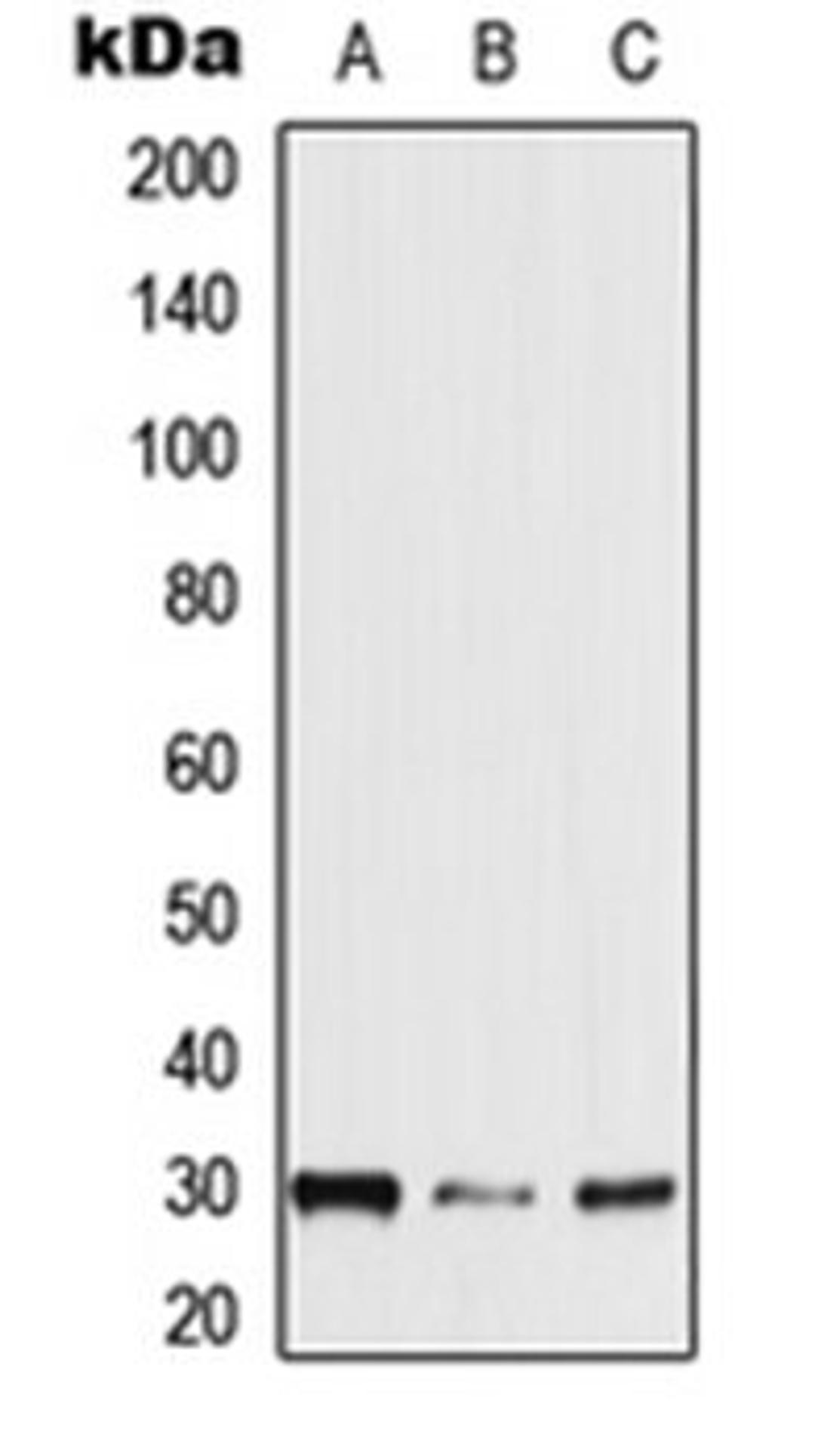 Western blot analysis of HEK293T (Lane 1), mouse brain (Lane 2), rat brain (Lane 3) whole cell lysates using NXPH2 antibody