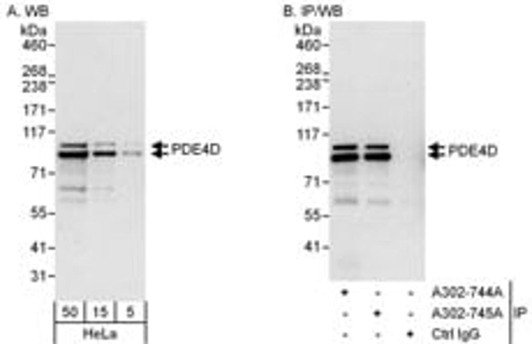 Detection of human PDE4D by western blot and immunoprecipitation.