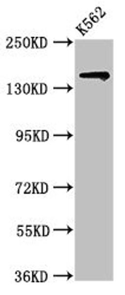 Western Blot. Positive WB detected in: K562 whole cell lysate. All lanes: SIN3A antibody at 2ug/ml. Secondary. Goat polyclonal to rabbit IgG at 1/50000 dilution. Predicted band size: 146 kDa. Observed band size: 146 kDa. 