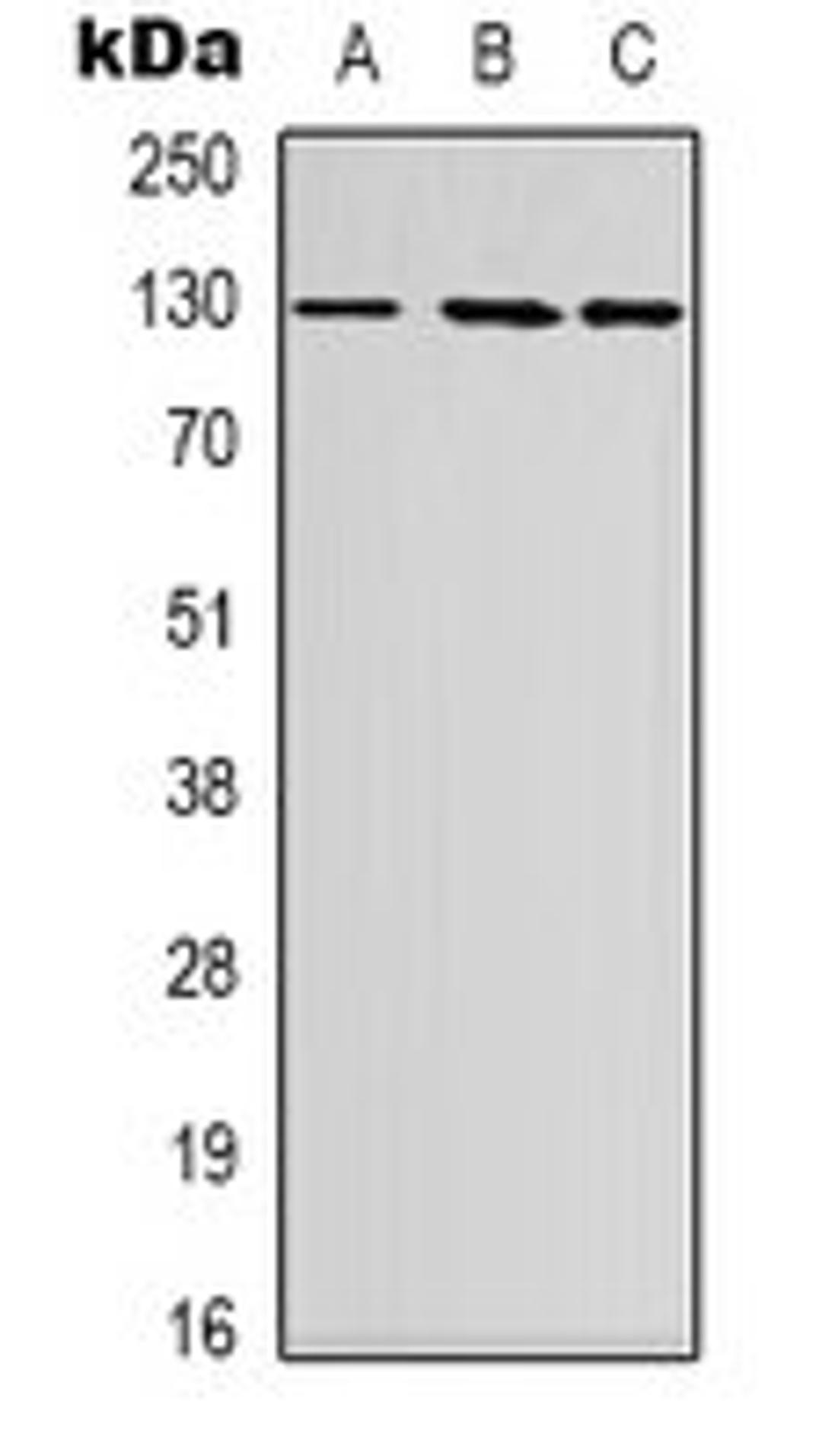 Western blot analysis of Hela (Lane 1), HEK293T (Lane 2), HepG2 (Lane 3) whole cell lysates using FOG2 antibody