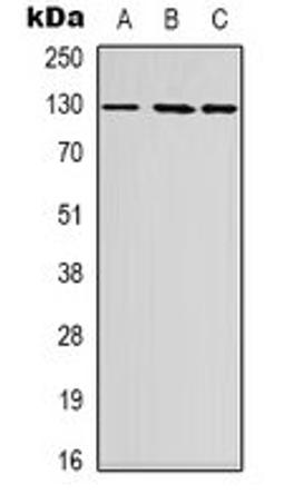 Western blot analysis of Hela (Lane 1), HEK293T (Lane 2), HepG2 (Lane 3) whole cell lysates using FOG2 antibody