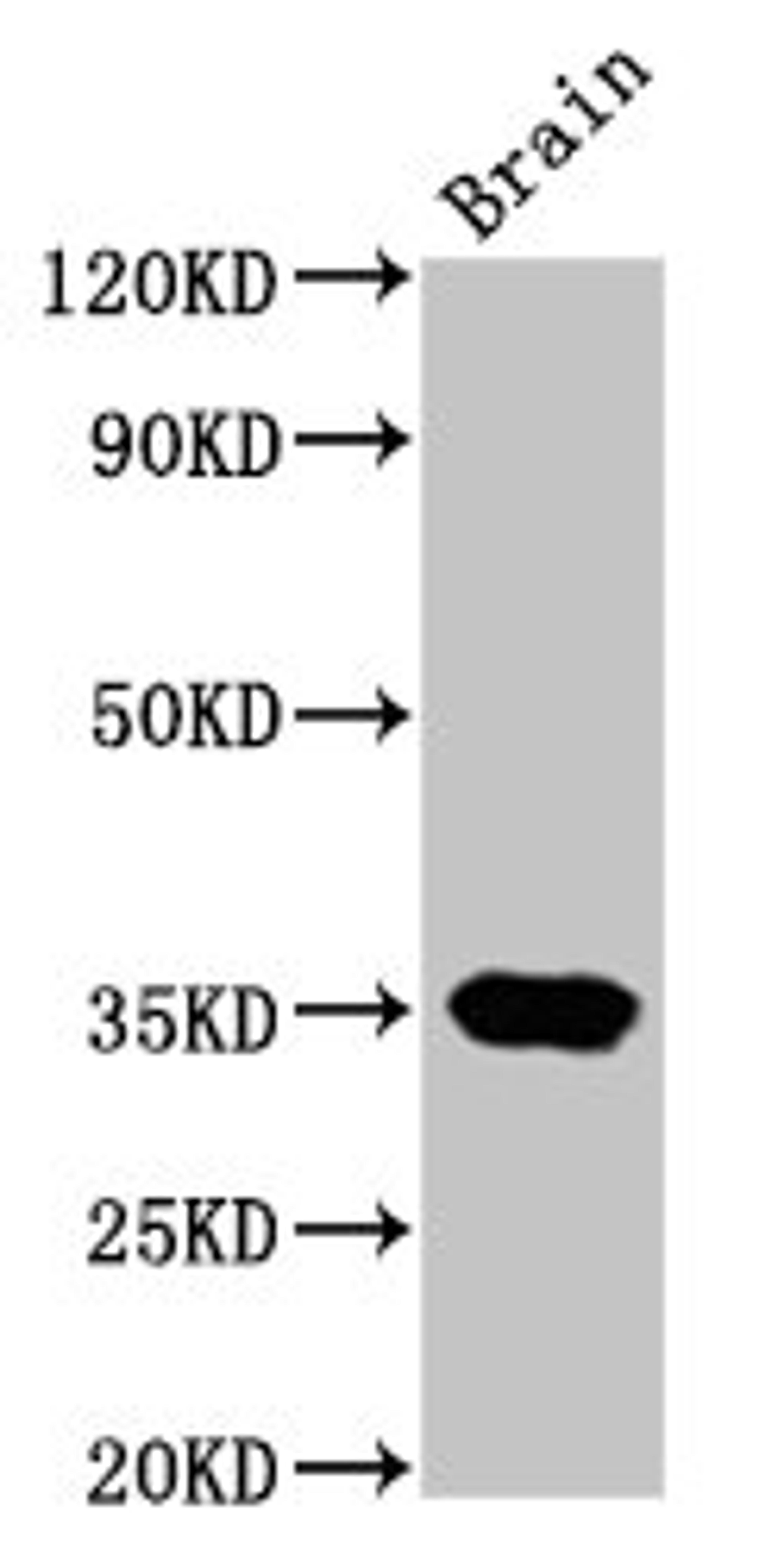 Western Blot. Positive WB detected in: Rat brain tissue. All lanes: NKX3-2 antibody at 4.5ug/ml. Secondary. Goat polyclonal to rabbit IgG at 1/50000 dilution. Predicted band size: 35 kDa. Observed band size: 35 kDa. 