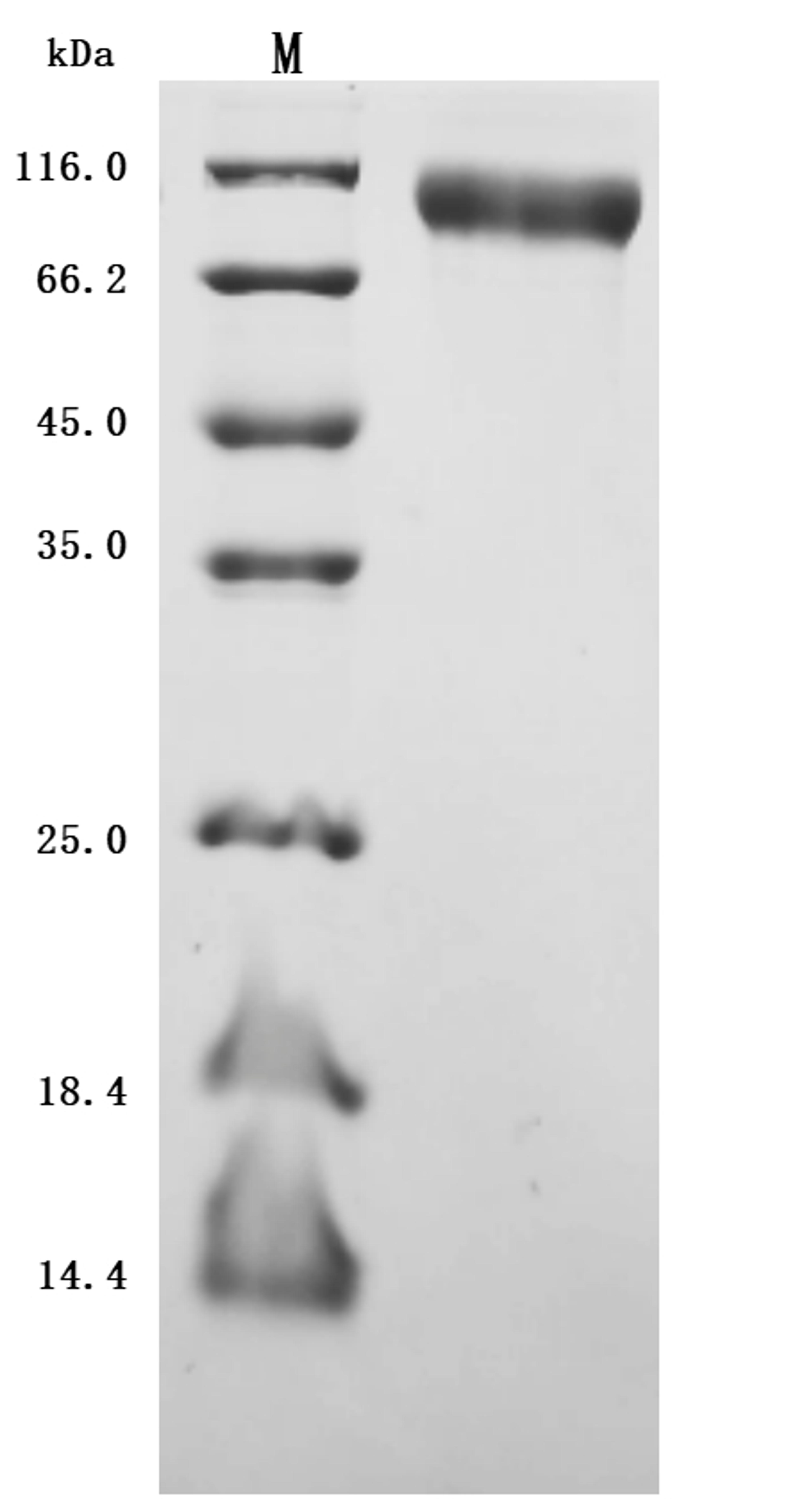 (Tris-Glycine gel) Discontinuous SDS-PAGE (reduced) with 5% enrichment gel and 15% separation gel.