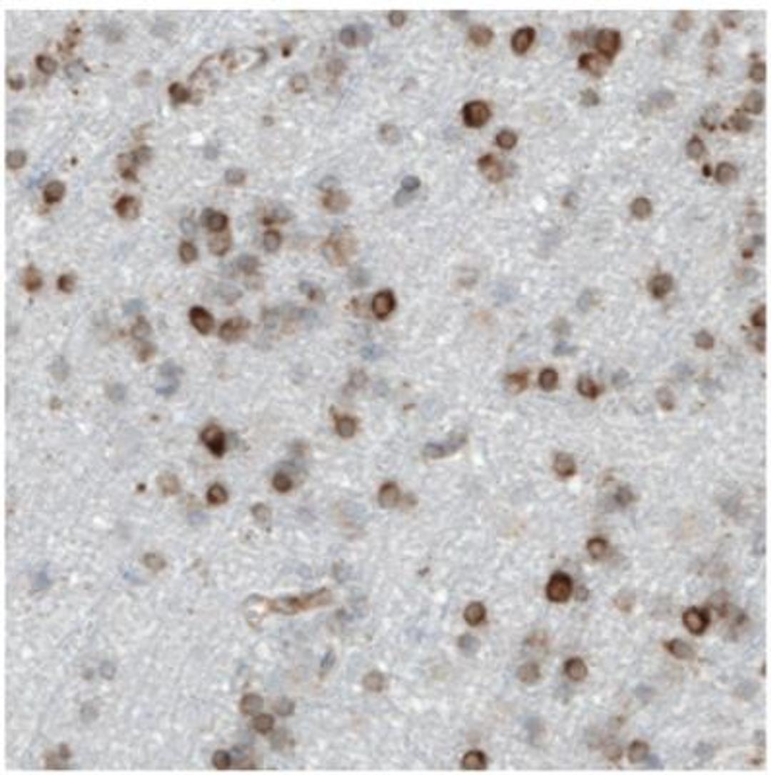 Immunohistochemistry: LYRIC Antibody (CL0401) [NBP2-30458] - Immunohistochemical staining of human cerebral cortex shows moderate to strong cytoplasmic positivity in glial cells.