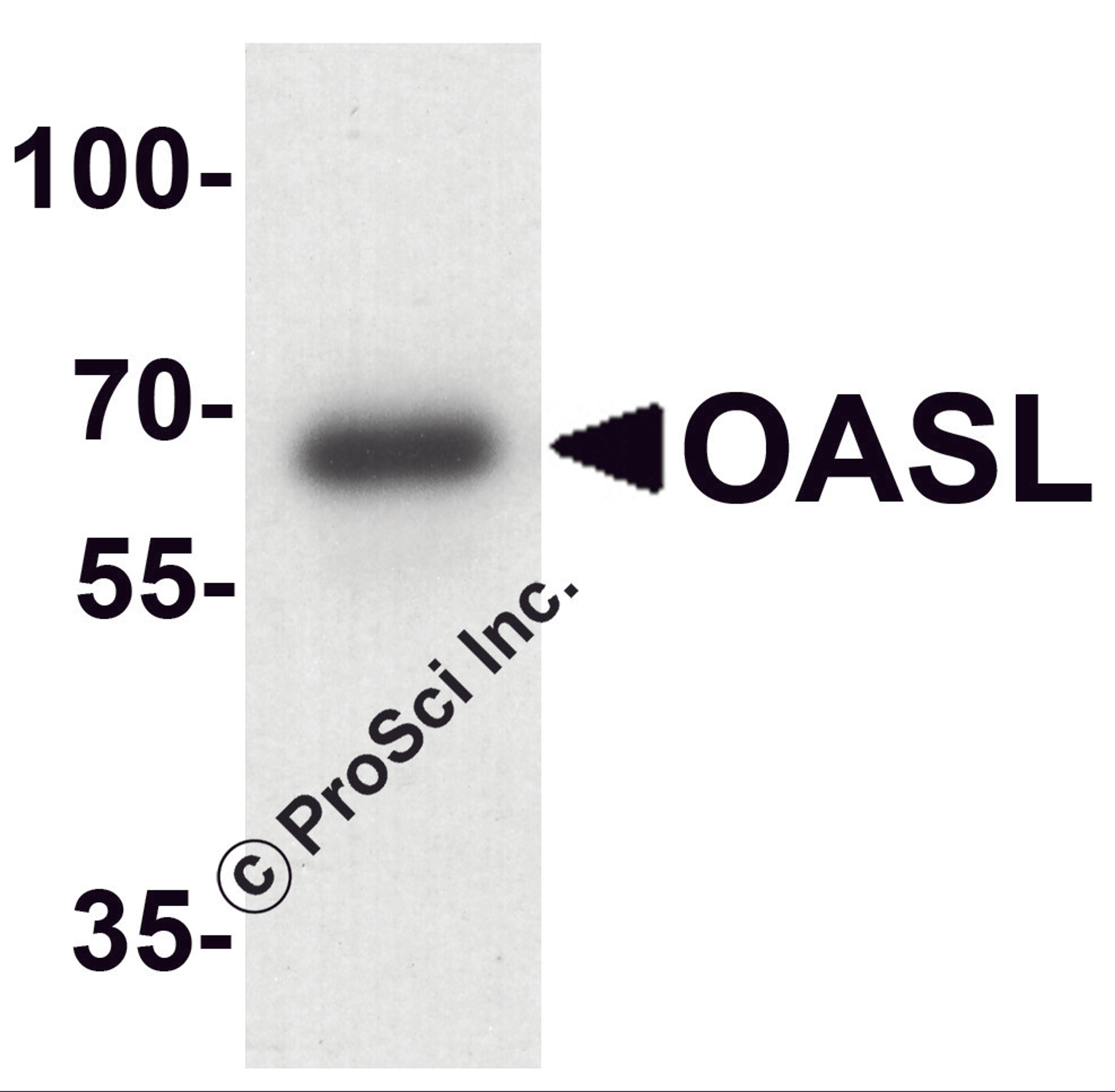 Western blot analysis of OASL in mouse bladder tissue lysate with OASL antibody at 1 μg/ml.