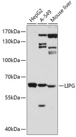 Western blot - LIPG antibody (A1891)