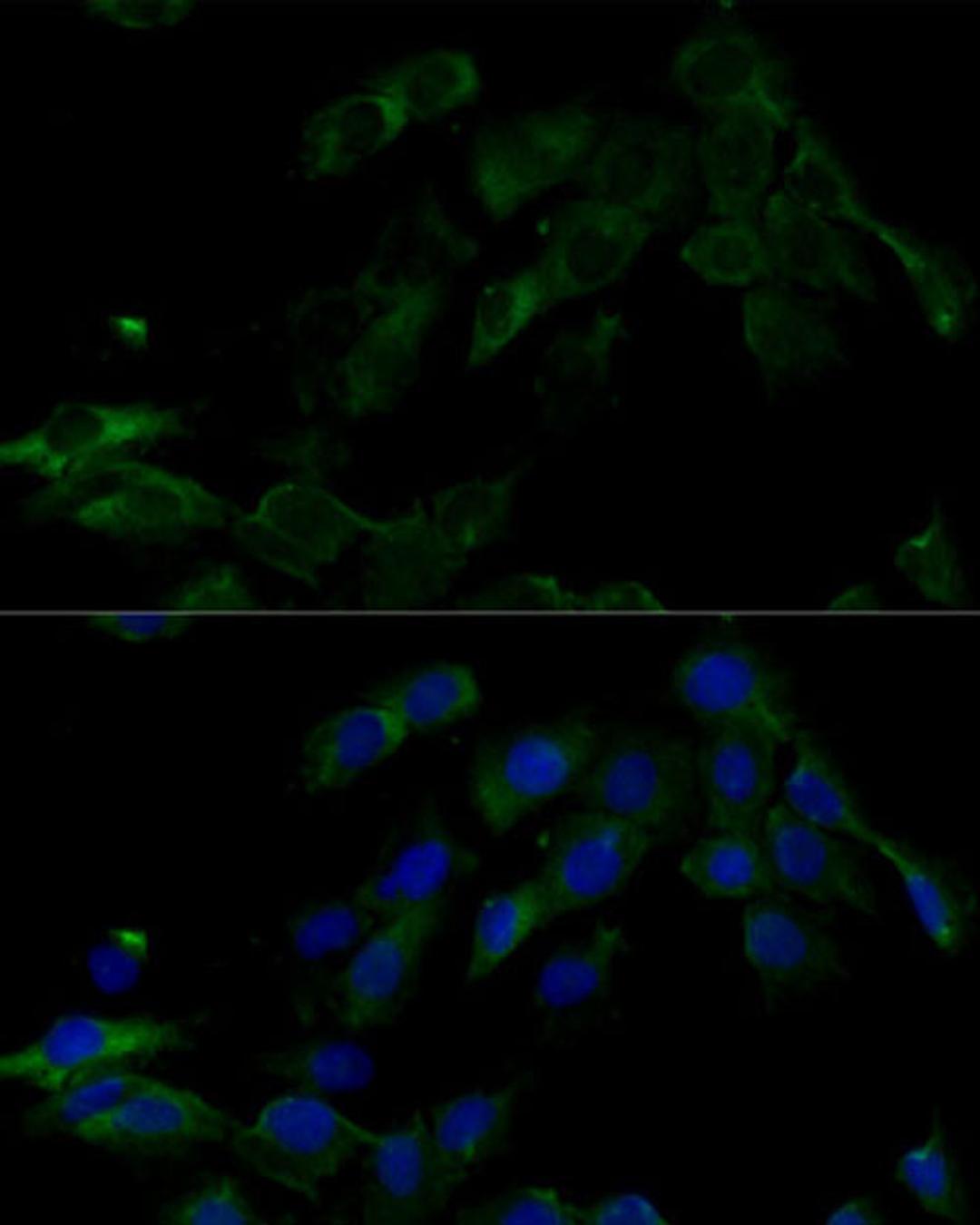 Immunofluorescence - ATP6V0C Polyclonal Antibody (A16350)