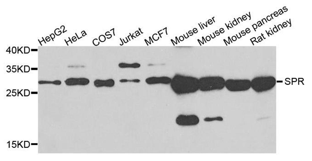 Western blot analysis of extracts of various cells using SPR antibody