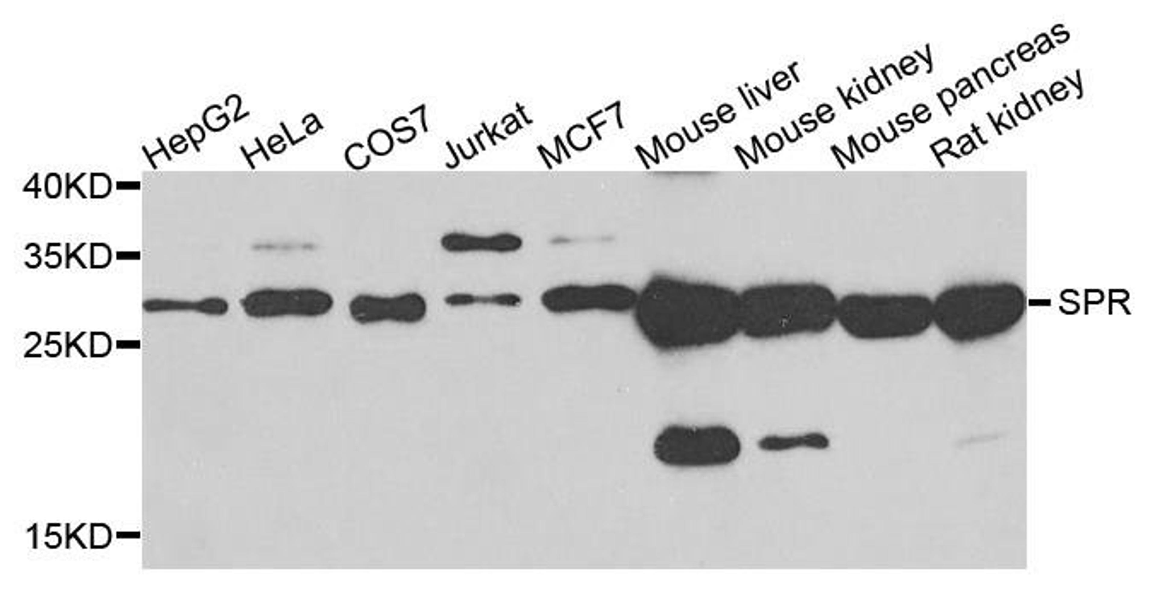 Western blot analysis of extracts of various cells using SPR antibody