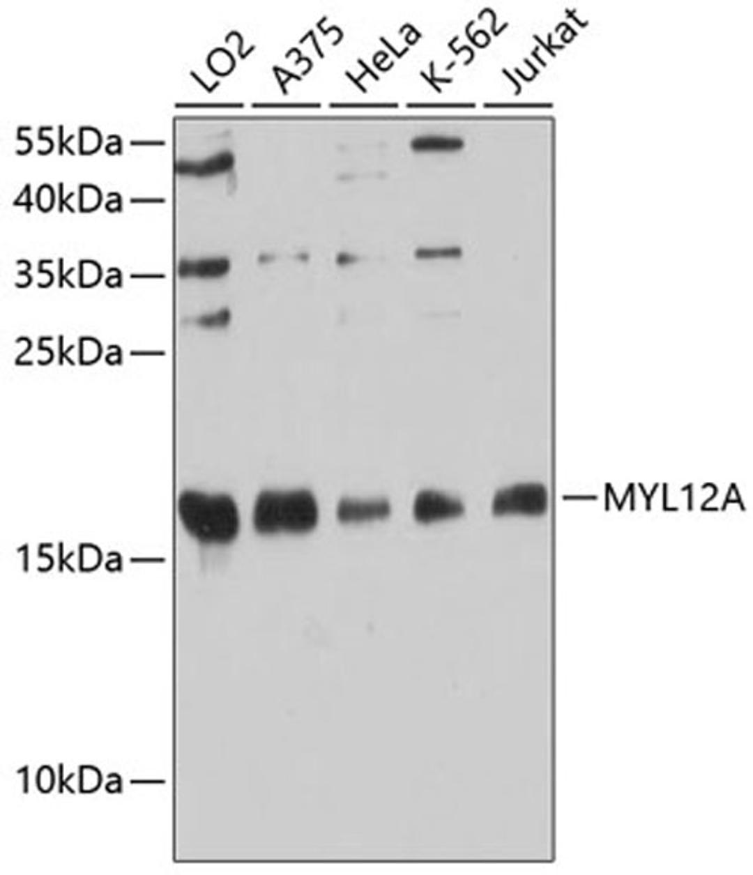 Western blot - MYL12A antibody (A9176)