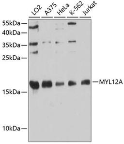 Western blot - MYL12A antibody (A9176)