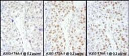 Detection of human HSF1 by immunohistochemistry.