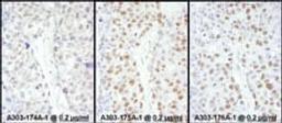 Detection of human HSF1 by immunohistochemistry.