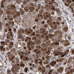 Immunohistochemistry: CYP24A1 Antibody [NBP1-85495] - Staining of human pancreas shows strong cytoplasmic positivity in exocrine cells.