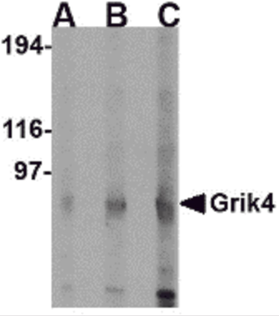 Western blot analysis of Grik4 in rat brain lysate with Grik4 antibody at (A) 0.5 (B) 1 and (C) 2 &#956;g/mL.