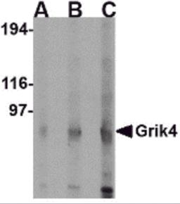 Western blot analysis of Grik4 in rat brain lysate with Grik4 antibody at (A) 0.5 (B) 1 and (C) 2 &#956;g/mL.