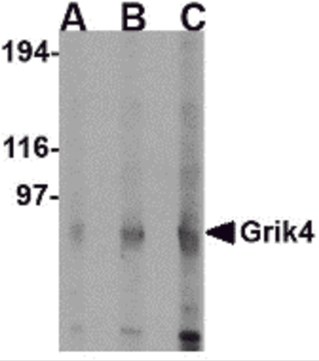 Western blot analysis of Grik4 in rat brain lysate with Grik4 antibody at (A) 0.5 (B) 1 and (C) 2 μg/mL.