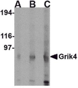 Western blot analysis of Grik4 in rat brain lysate with Grik4 antibody at (A) 0.5 (B) 1 and (C) 2 μg/mL.