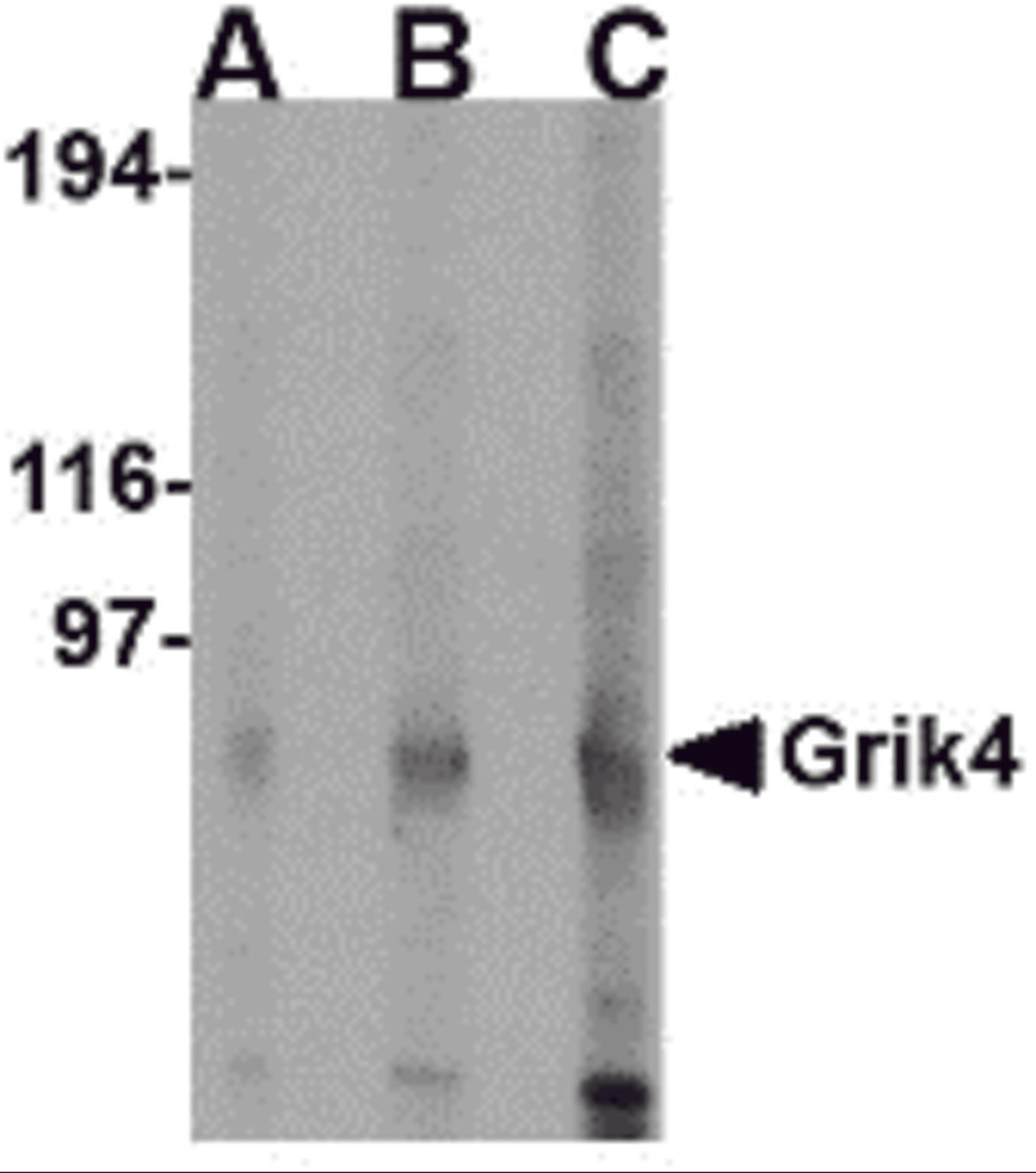 Western blot analysis of Grik4 in rat brain lysate with Grik4 antibody at (A) 0.5 (B) 1 and (C) 2 μg/mL.