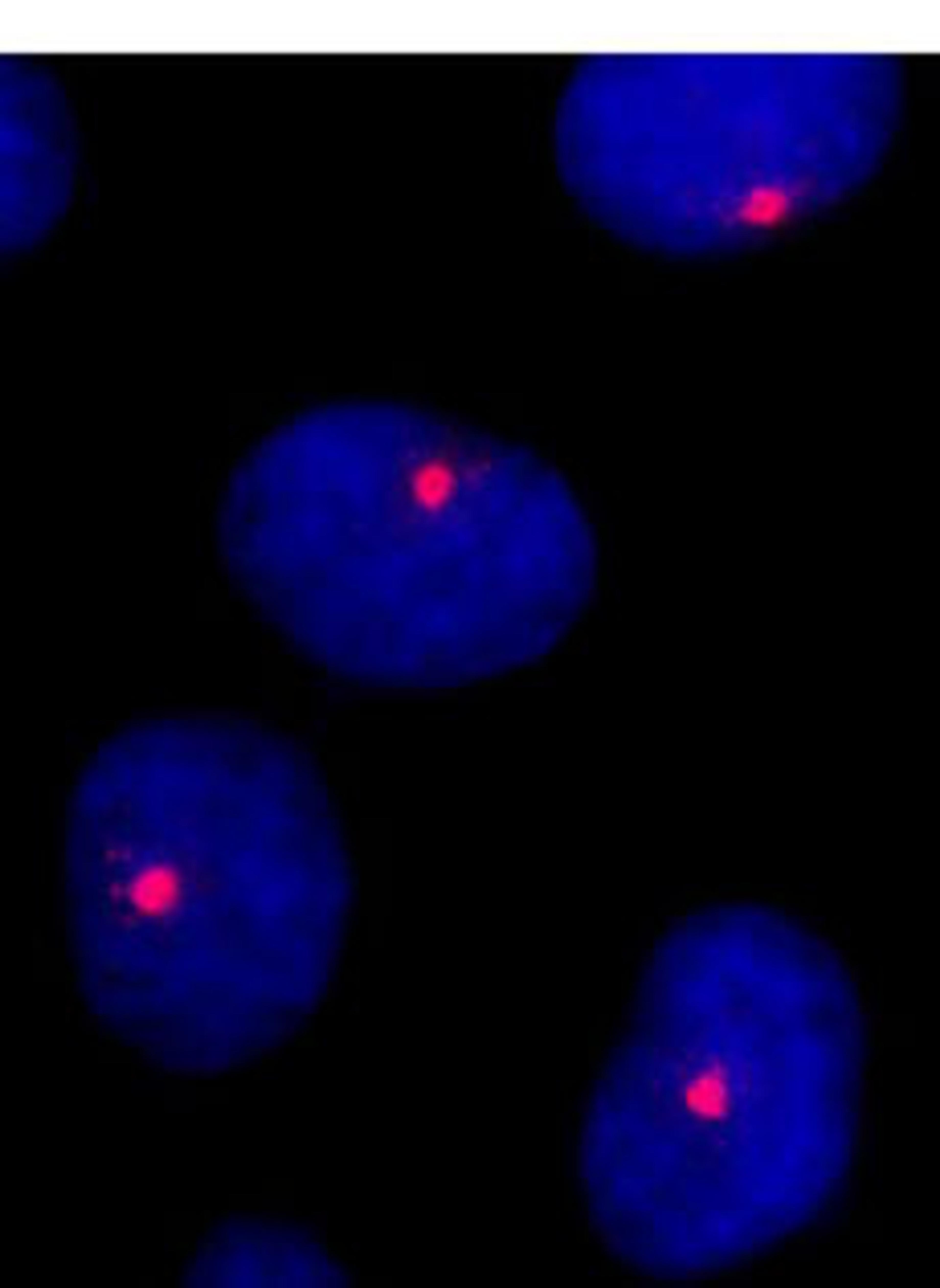 Detection of human CEP131/AZ1 by immunocytochemistry.