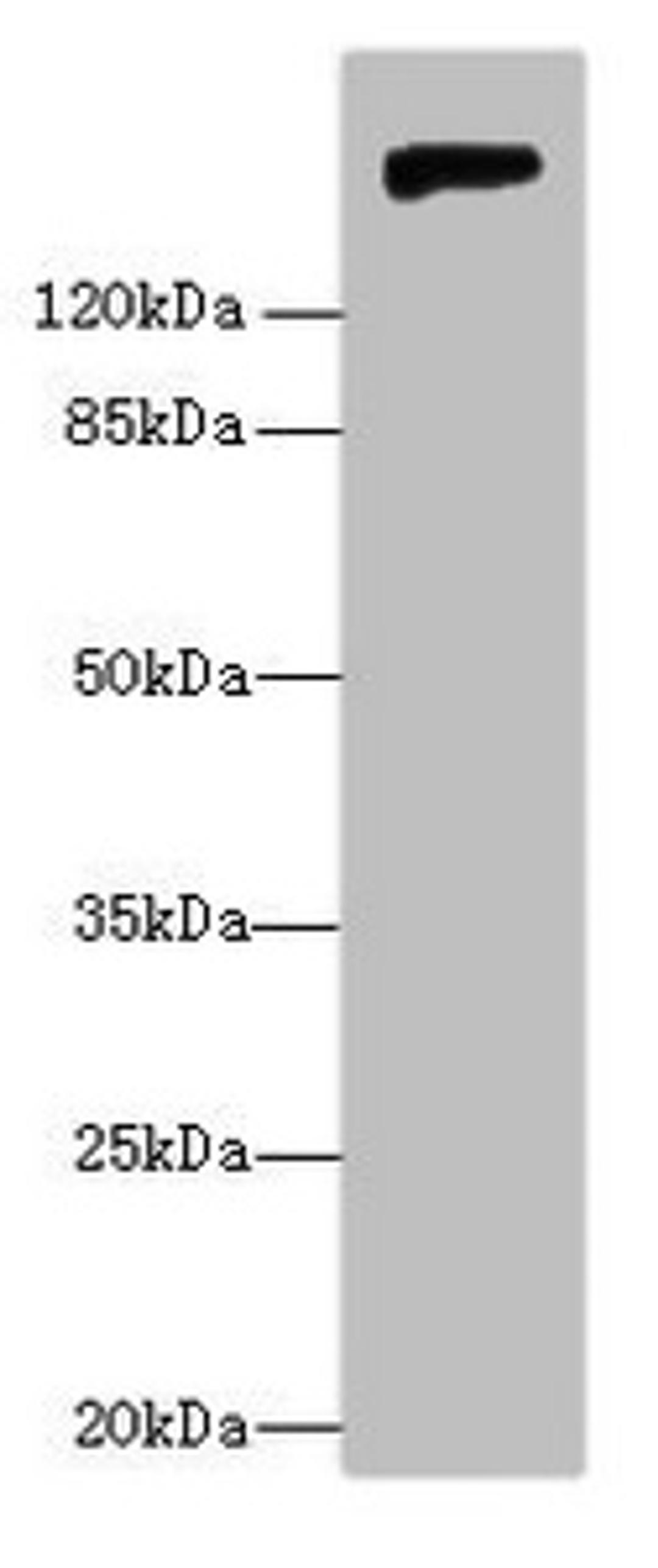 Western blot. All lanes: Nid1 antibody at 6µg/ml + Rat lung tissue. Secondary. Goat polyclonal to rabbit IgG at 1/10000 dilution. Predicted band size: 137 kDa. Observed band size: 150 kDa