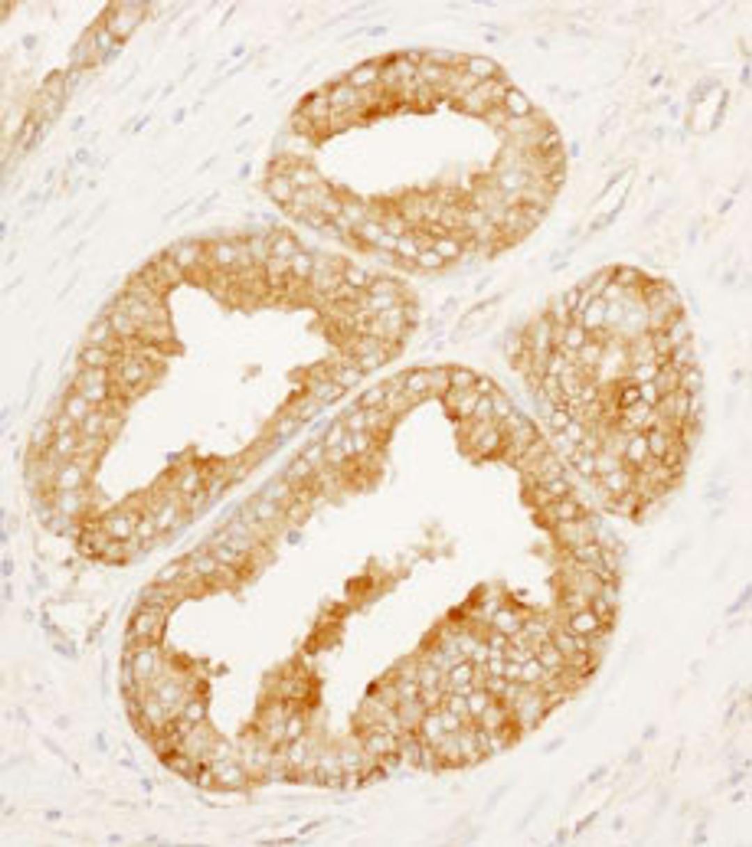 Detection of human MARCKS-like 1 by immunohistochemistry.