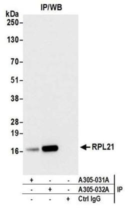 Detection of human RPL21 by western blot of immunoprecipitates.