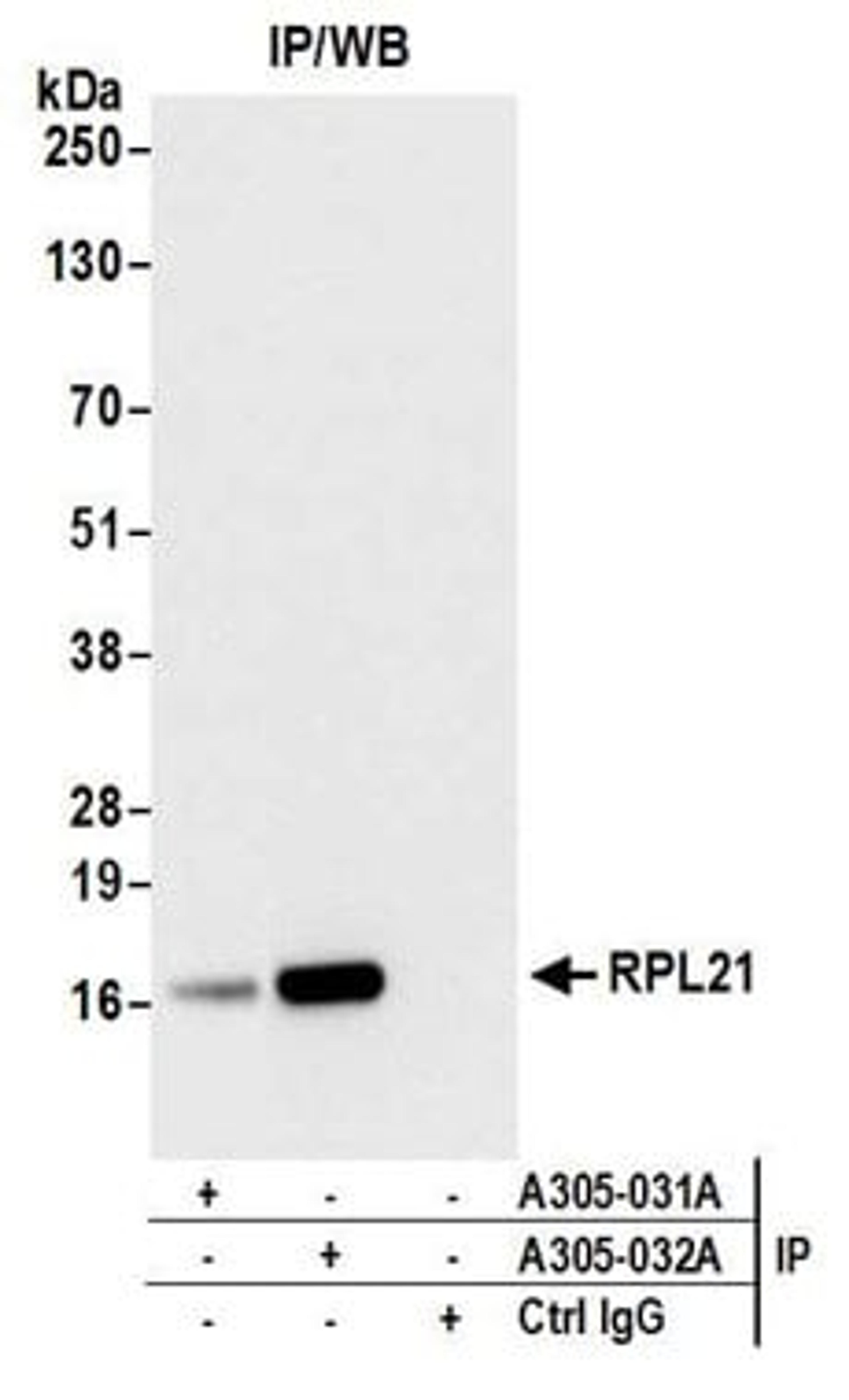 Detection of human RPL21 by western blot of immunoprecipitates.