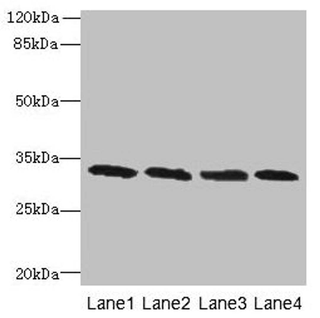 Western blot. All lanes: PNP antibody at 16µg/ml. Lane 1: Jurkat whole cell lysate. Lane 2: K562 whole cell lysate. Lane 3: U937 whole cell lysate. Lane 4: 293T whole cell lysate. Secondary. Goat polyclonal to rabbit IgG at 1/10000 dilution. Predicted band size: 33 kDa. Observed band size: 33 kDa