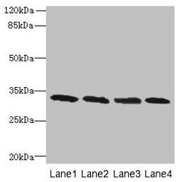 Western blot. All lanes: PNP antibody at 16µg/ml. Lane 1: Jurkat whole cell lysate. Lane 2: K562 whole cell lysate. Lane 3: U937 whole cell lysate. Lane 4: 293T whole cell lysate. Secondary. Goat polyclonal to rabbit IgG at 1/10000 dilution. Predicted band size: 33 kDa. Observed band size: 33 kDa