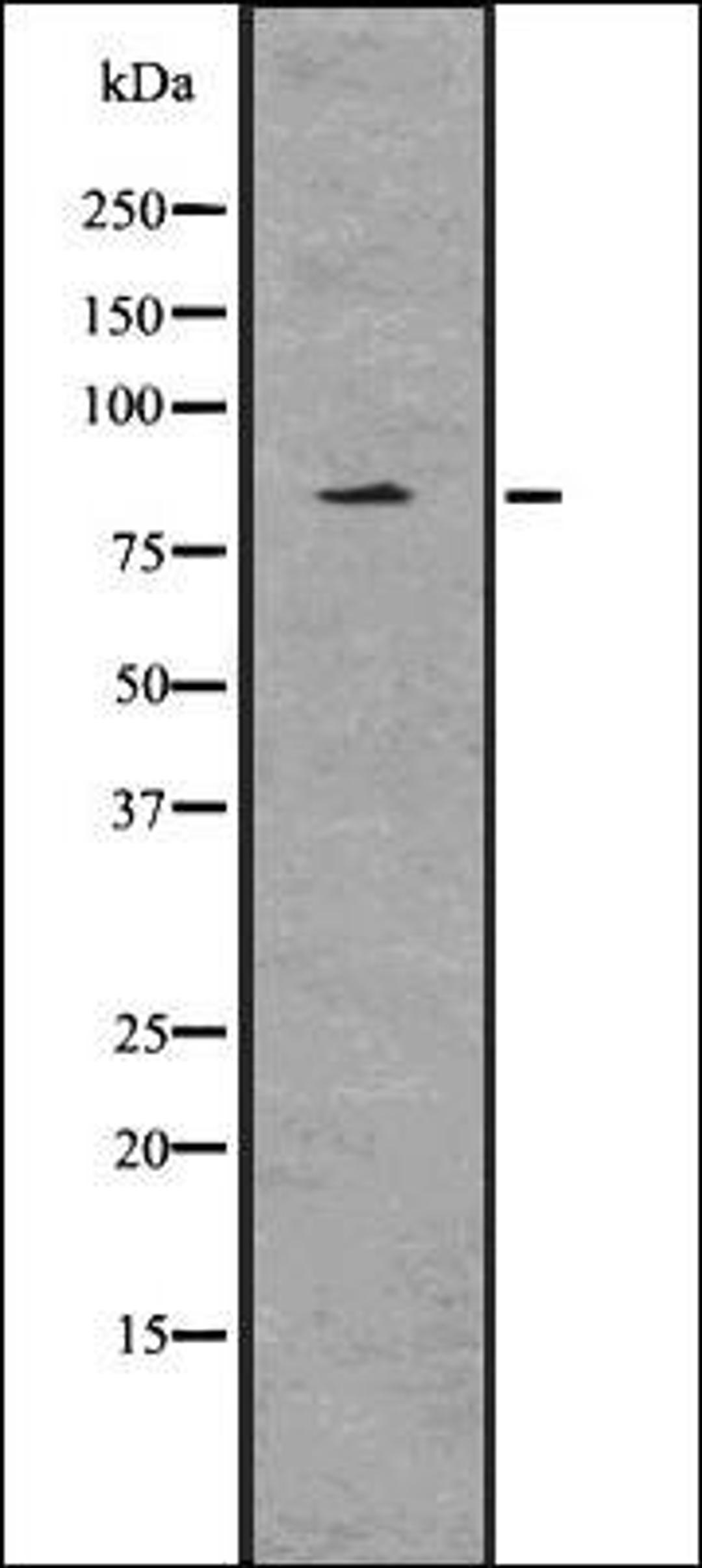 Western blot analysis of HeLa whole cell lysates using EZH2 -phospho T487- antibody