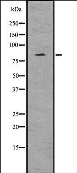 Western blot analysis of HeLa whole cell lysates using EZH2 -phospho T487- antibody