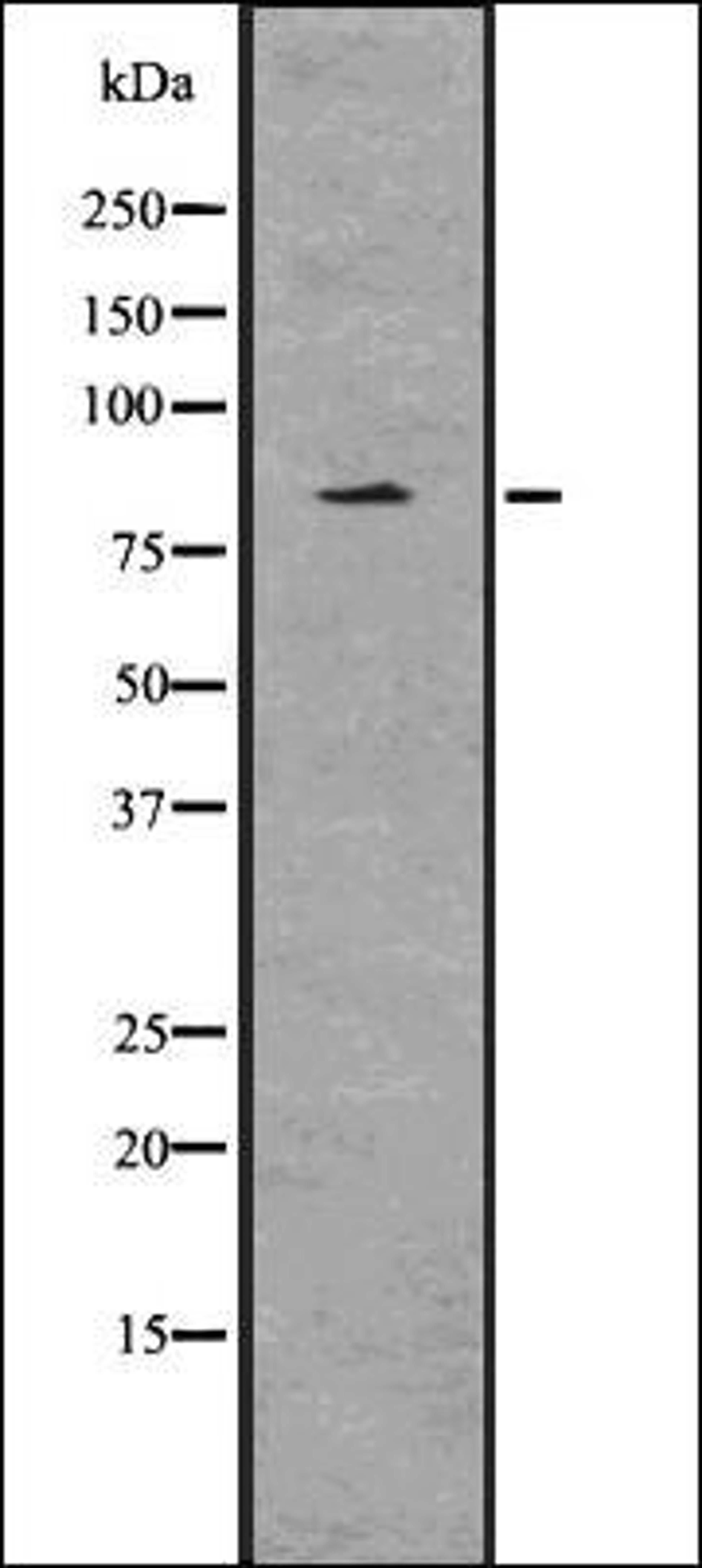 Western blot analysis of HeLa whole cell lysates using EZH2 -phospho T487- antibody