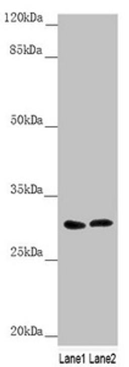 Western blot. All lanes: SNAP29 antibody at 1.79µg/ml. Lane 1: 293T whole cell lysate. Lane 2: Jurkat whole cell lysate. Secondary. Goat polyclonal to rabbit IgG at 1/10000 dilution. Predicted band size: 29 kDa. Observed band size: 29 kDa